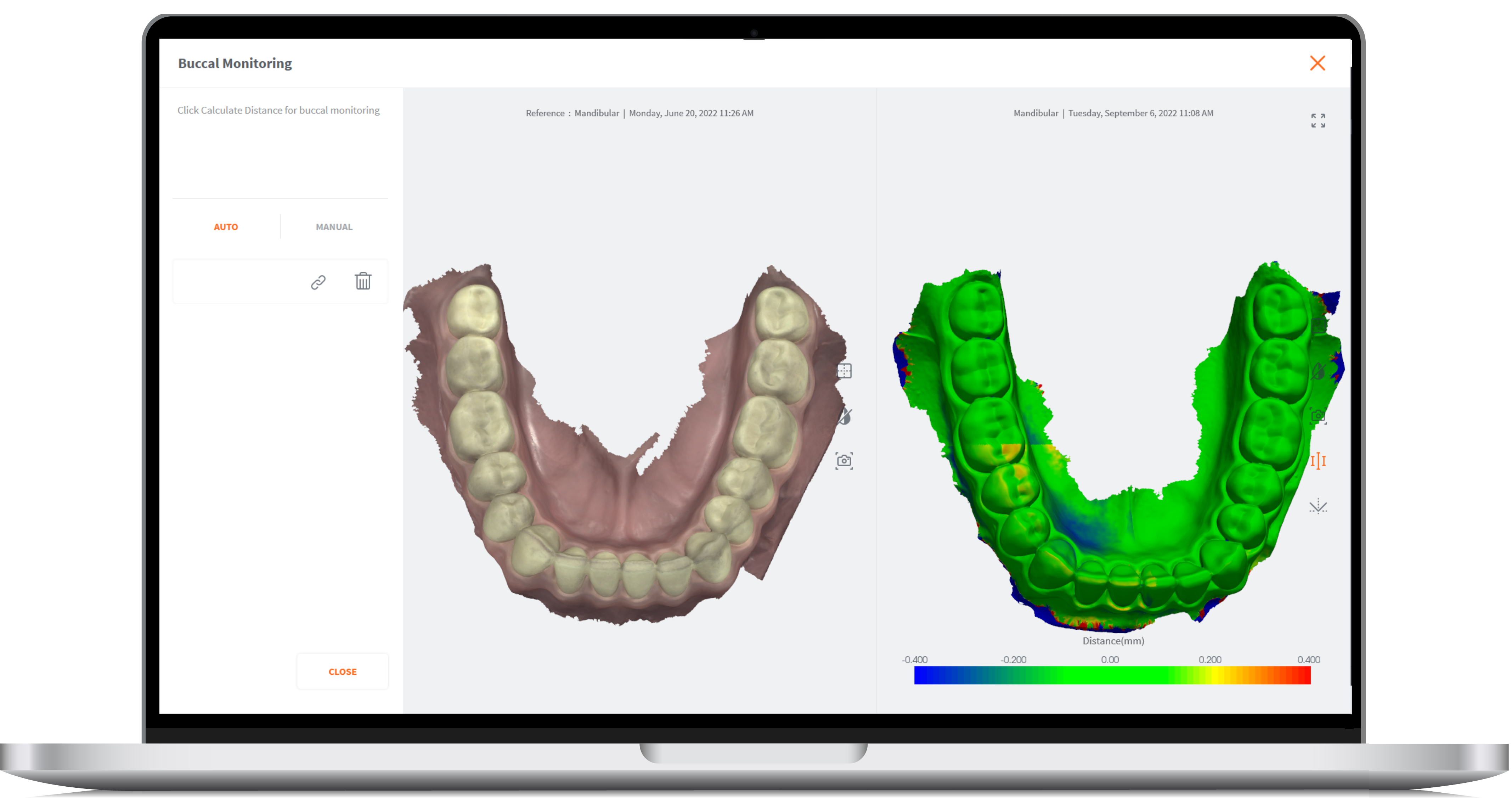 Adding a patient profile